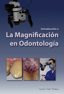 Introducción a la magnificación en odontología