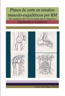 Planos de corte en estudios musculo-ésqueléticos por RM