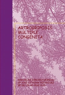 ARTROGRIPOSIS MÚLTIPLE CONGÉNITA