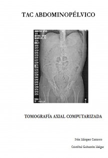 TAC Abdominopélvico