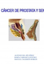 CANCER DE PROSTATA Y DE SENOS