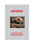 ARTROSIS