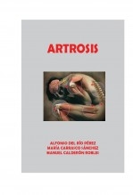 ARTROSIS