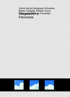 Coagulación y Fibrinolisis