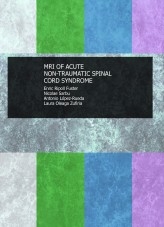 MRI OF ACUTE NON-TRAUMATIC SPINAL CORD SYNDROME