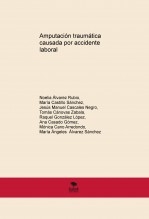 Amputación traumática causada por accidente laboral