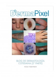 Dermapixel: Blog de Dermatología Cotidiana (2ª Parte)