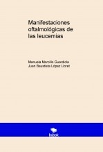 Manifestaciones oftalmológicas de las leucemias
