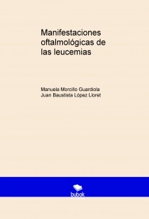 Manifestaciones oftalmológicas de las leucemias