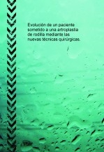 Evolución de un paciente sometido a una artroplastia de rodilla mediante las nuevas técnicas quirúrgicas.