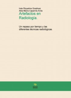 Artefactos en Radiología. Un repaso por tiempo y las diferentes técnicas radiológicas.