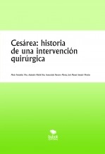 Libro Cesárea: historia de una intervención quirúrgica, autor María Fernández Vivo