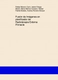 Fusión de Imágenes en planificador de Radioterapia Externa Pinnacle