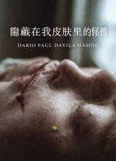 隐藏在我皮肤里的怪兽