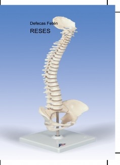 RESES
